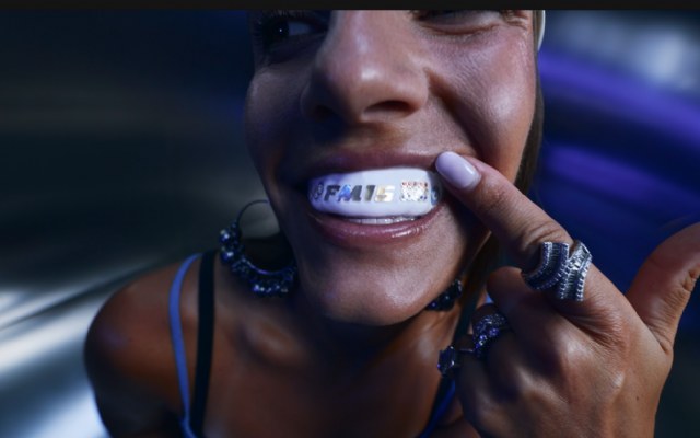 Rabobank lanceert Gem Guards: gepersonaliseerde bitjes voorzien van tooth gems